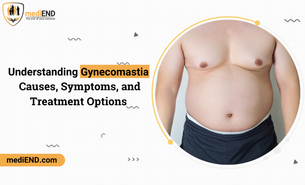 Gynecomastia: Causes, Symptoms, and Treatment Options