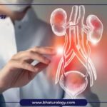 Best Urologist In Jaipur | Most Advanced Urology Treatments