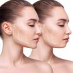 Facial Rejuvenation Explained: Procedures, Costs, and Results