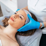 Chemical skin peel treatment in Islamabad