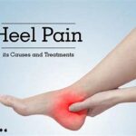 Causes of heel Pain