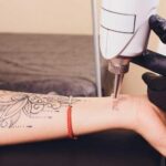 10 Tips for Stress-Free Tattoo Removal in Dubai