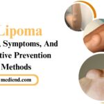 Lipoma Causes, Symptoms, And Effective Prevention Methods