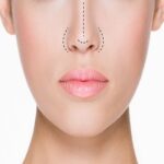 The Art and Science of Rhinoplasty: A Comprehensive Guide to Nose Reshaping