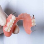 Crafting Beautiful Smiles With Our Dentures Services In Casula