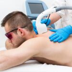 Exploring Hair Removal in the Intimate Area for Men in Dubai