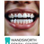 Specialized Pediatric Dentistry in Wandsworth